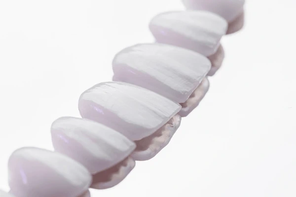 dental veneers in victoria, bc