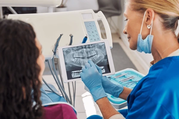 digital x-rays in victoria, bc