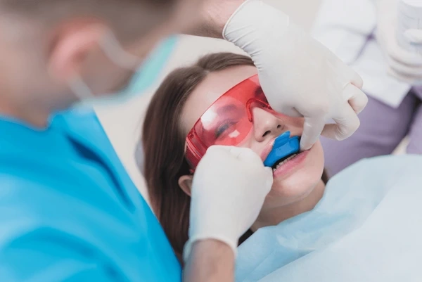 fluoride treatment in victoria, bc