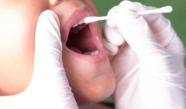 fluoride treatment near you