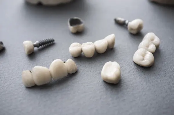 dental ceramics near you