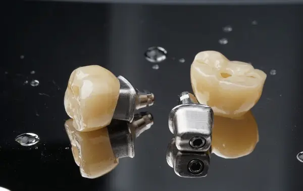 implant crowns near you